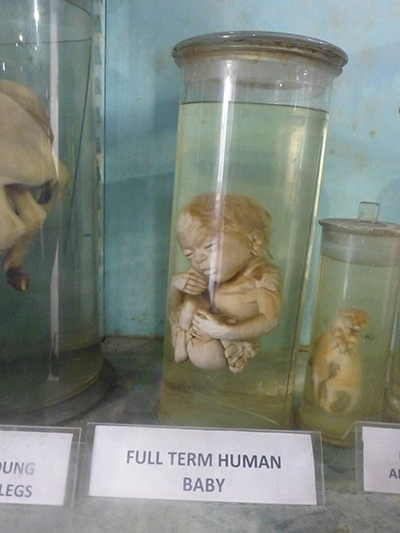 Human fetus.